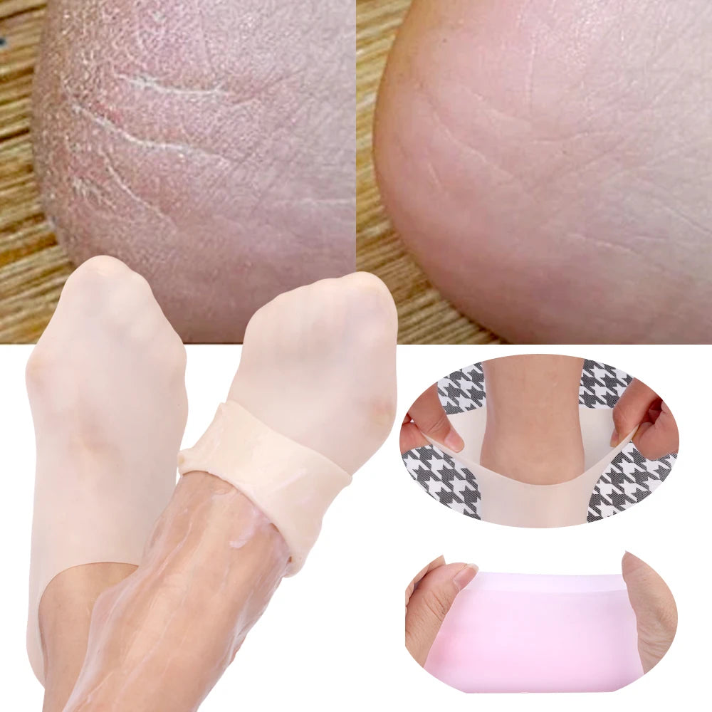 1Pairs Silicone Moisturizing Foot Socks - Foot care Massage Pedicure Socks